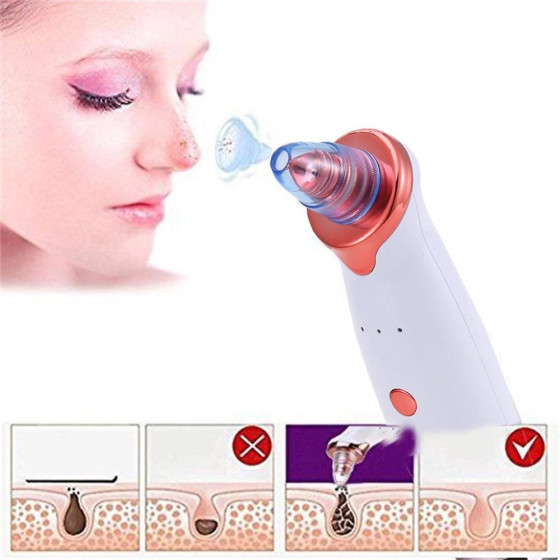 Вакуумен уред за почистване на лицето Power Perfect Pore - Дълбоко почистване