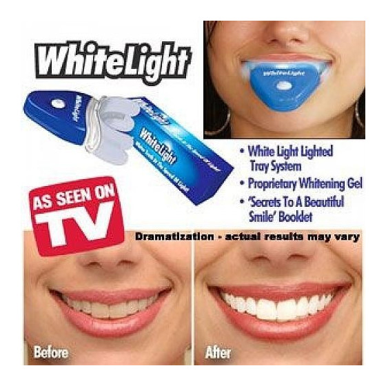 Ефективна система за избелване на зъби Whitelight
