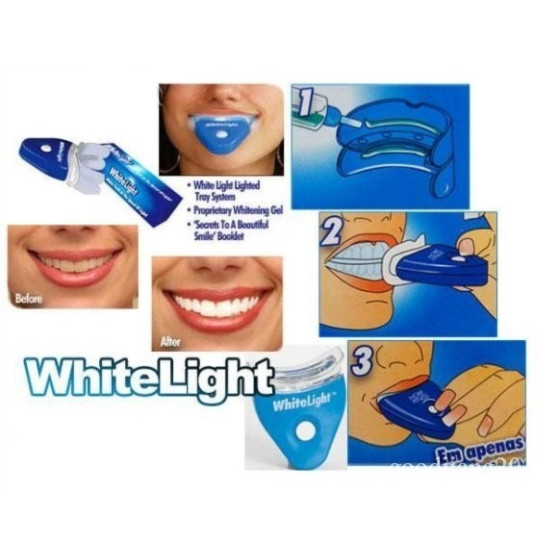 Ефективна система за избелване на зъби Whitelight