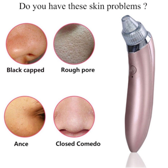 Ефективен вакуумен уред за черни точки | Чиста и здрава кожа